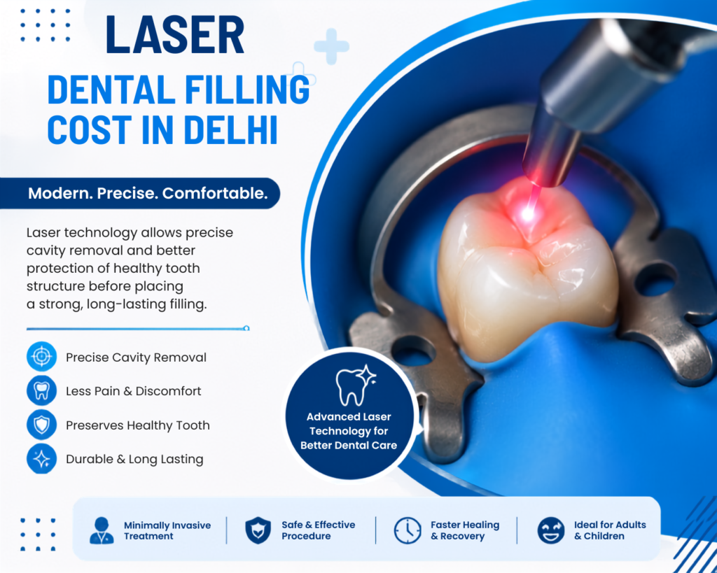 Laser filling cost in India
